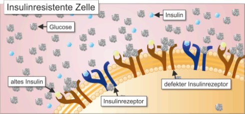 insulinresistente Zelle
